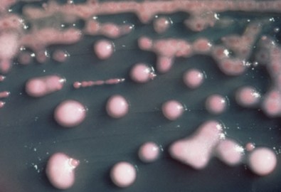 Trung Quốc cảnh báo cao độ về siêu vi khuẩn NDM1