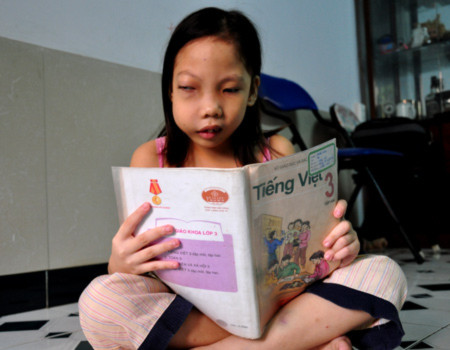 Luôn muốn được đến trường, Trang không biết cuộc sống mình chỉ còn được tính bằng ngày vì bệnh tật. Ảnh: Thiên Chương.