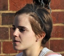 Emma Watson bất ngờ “lộ” da mặt sần sùi