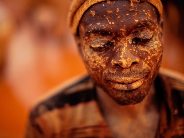 Khuôn mặt nhuộm bùn đất của một thợ mỏ khai thác vàng ở Manica, Mozambique - Ảnh: Robin Hammond.