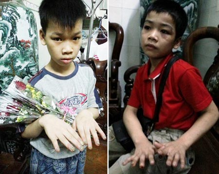 Tên Hồ Đình Châu bị khởi tố tội danh Hành hạ người khác.