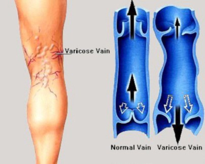 Bệnh lạ xuất hiện trên cơ thể đàn ông