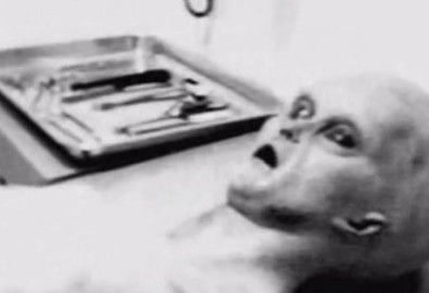 Hình ảnh cắt từ một đoạn video, được cho là ghi lại sau khi mổ tử thi người ngoài hành tinh. (Ảnh: YouTube/Dietrolafacciata)