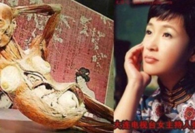 Bộ xương người có nhiều nét giống nữ MC Trương Vĩ Kiệt