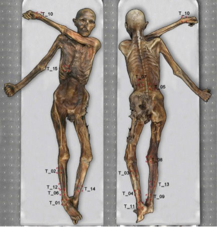 Phát hiện 61 hình xăm trên xác ướp người băng Otzi