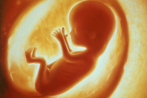 Hình ảnh Bất ngờ phát hiện bào thai chết lưu trọng bụng cậu bé 4 tuổi số 1